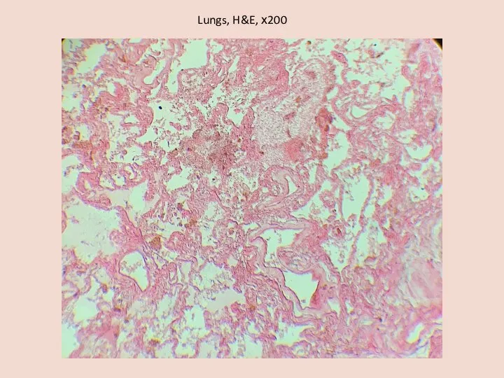 Lungs, H&E, х200