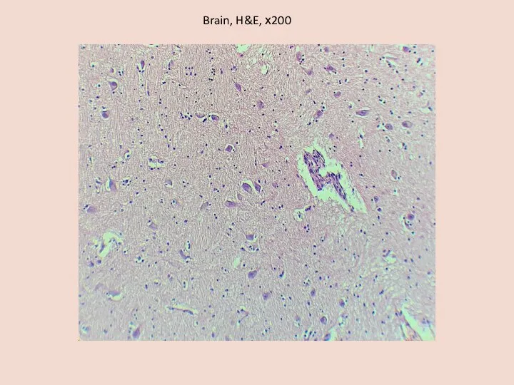 Brain, H&E, х200