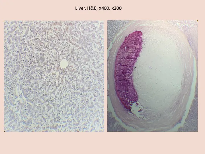 Liver, H&E, х400, x200