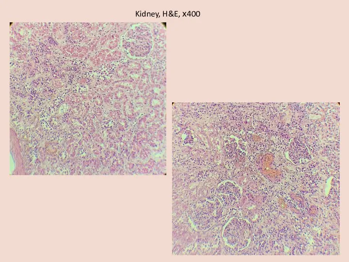 Kidney, H&E, х400