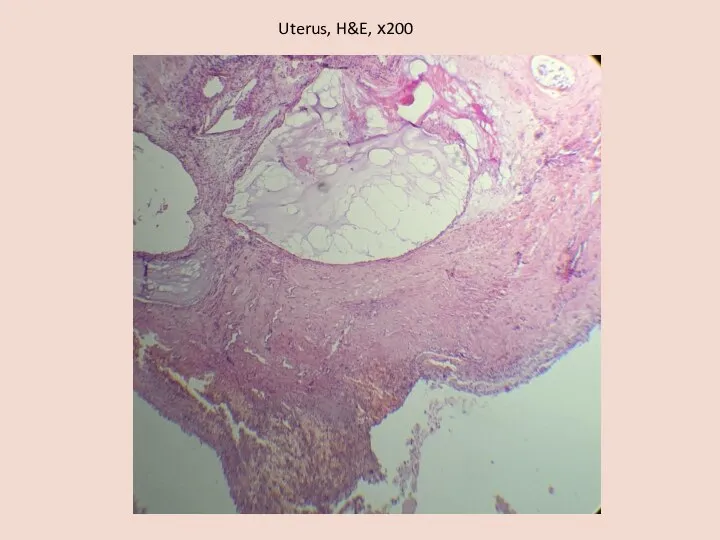 Uterus, H&E, х200