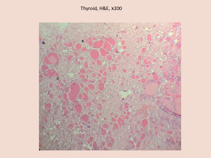 Thyroid, H&E, х200