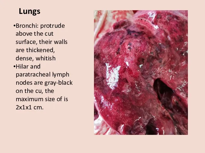 Lungs Bronchi: protrude above the cut surface, their walls are thickened, dense,