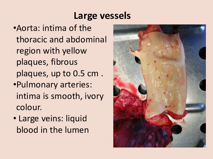Large vessels Aorta: intima of the thoracic and abdominal region with yellow