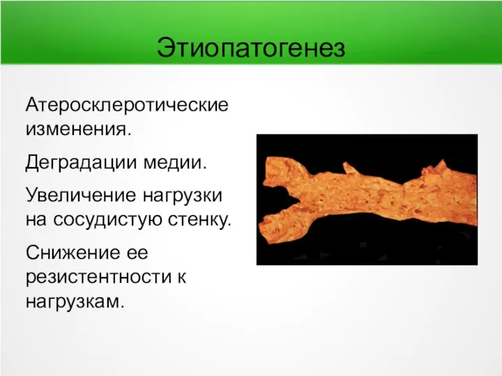 Этиопатогенез Атеросклеротические изменения. Деградации медии. Увеличение нагрузки на сосудистую стенку. Снижение ее резистентности к нагрузкам.