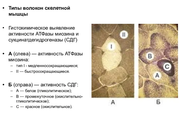 Типы волокон скелетной мышцы Гистохимическое выявление активности АТФазы миозина и сукцинатдегидрогеназы (СДГ)