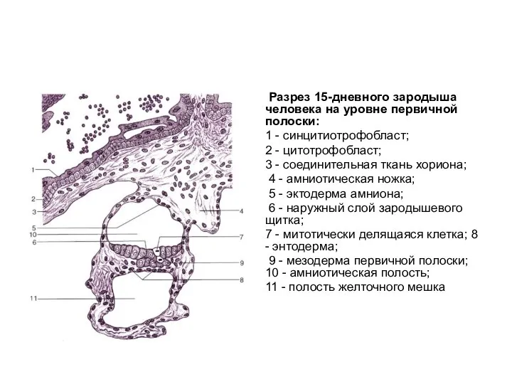 Разрез 15-дневного зародыша человека на уровне первичной полоски: 1 - синцитиотрофобласт; 2