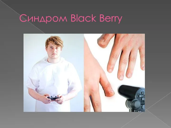 Синдром Black Berry