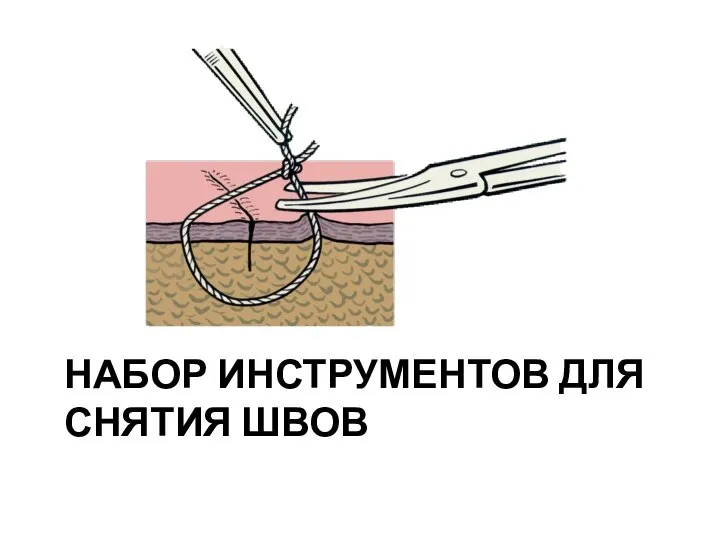 НАБОР ИНСТРУМЕНТОВ ДЛЯ СНЯТИЯ ШВОВ