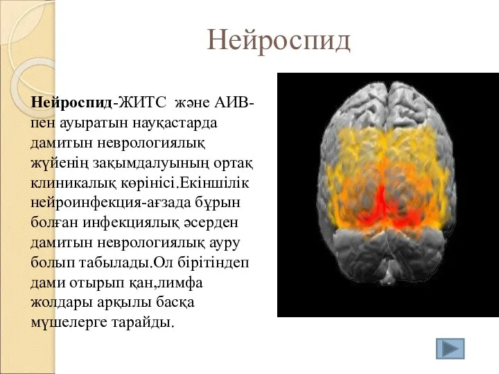 Нейроспид Нейроспид-ЖИТС және АИВ-пен ауыратын науқастарда дамитын неврологиялық жүйенің зақымдалуының ортақ клиникалық