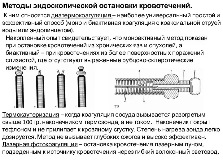 Методы эндоскопической остановки кровотечений. К ним относятся диатермокоагуляция – наиболее универсальный простой