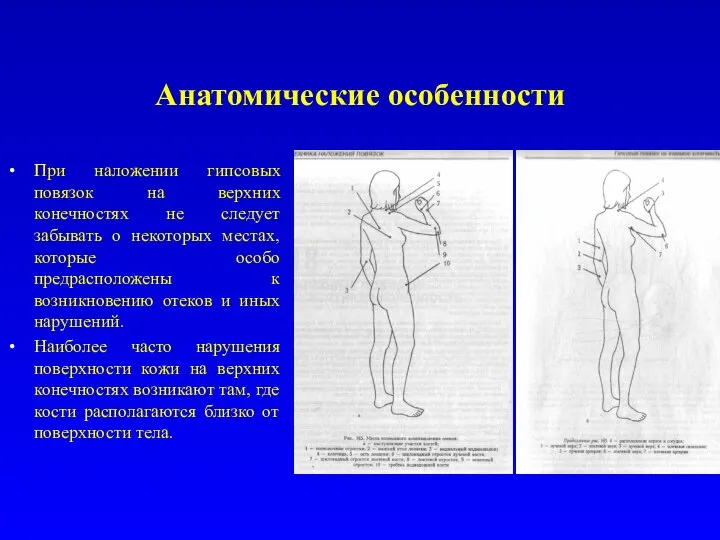 Анатомические особенности При наложении гипсовых повязок на верхних конечностях не следует забывать