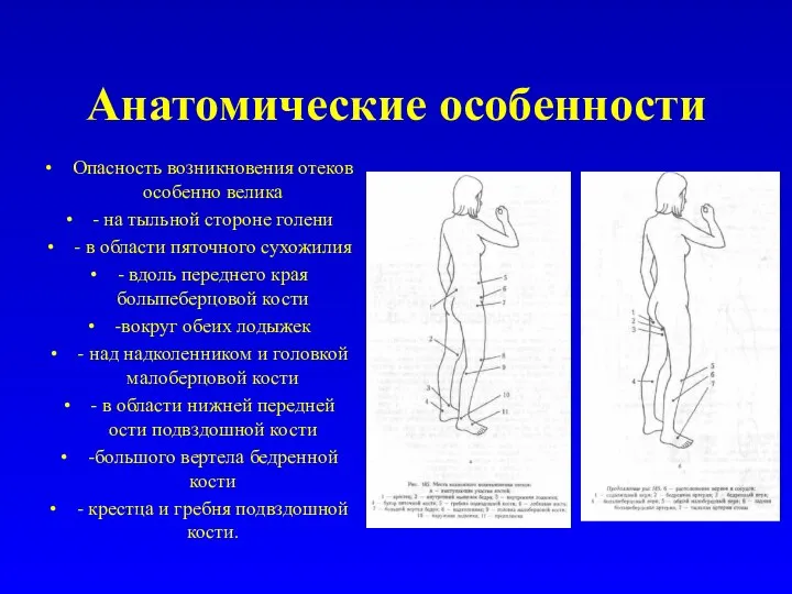 Анатомические особенности Опасность возникновения отеков особенно велика - на тыльной стороне голени