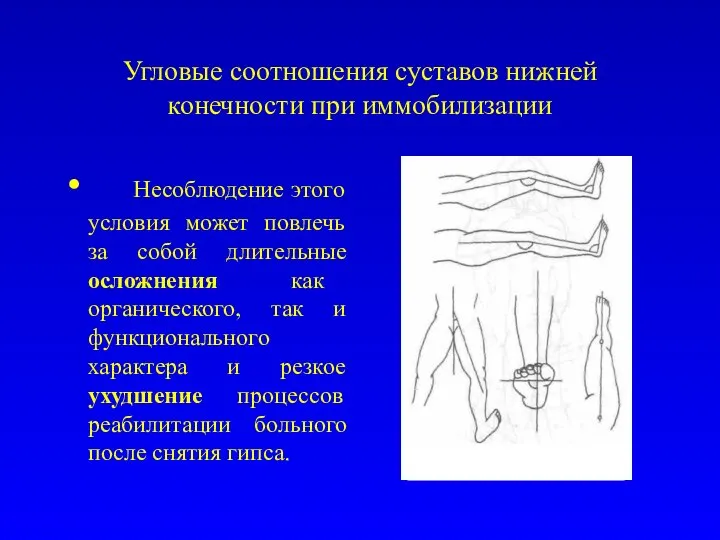 Угловые соотношения суставов нижней конечности при иммобилизации Несоблюдение этого условия может повлечь