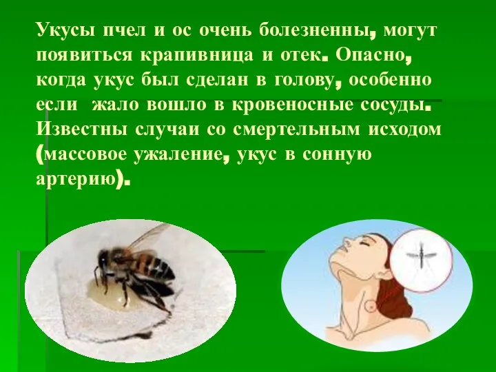 Укусы пчел и ос очень болезненны, могут появиться крапивница и отек. Опасно,