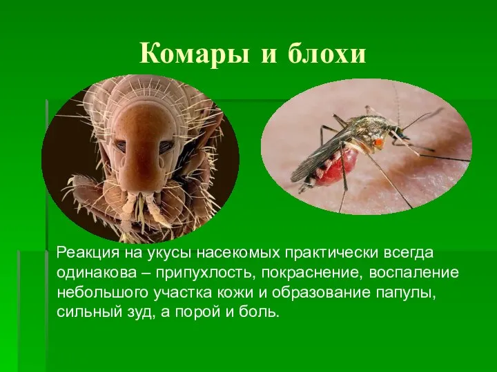 Комары и блохи Реакция на укусы насекомых практически всегда одинакова – припухлость,