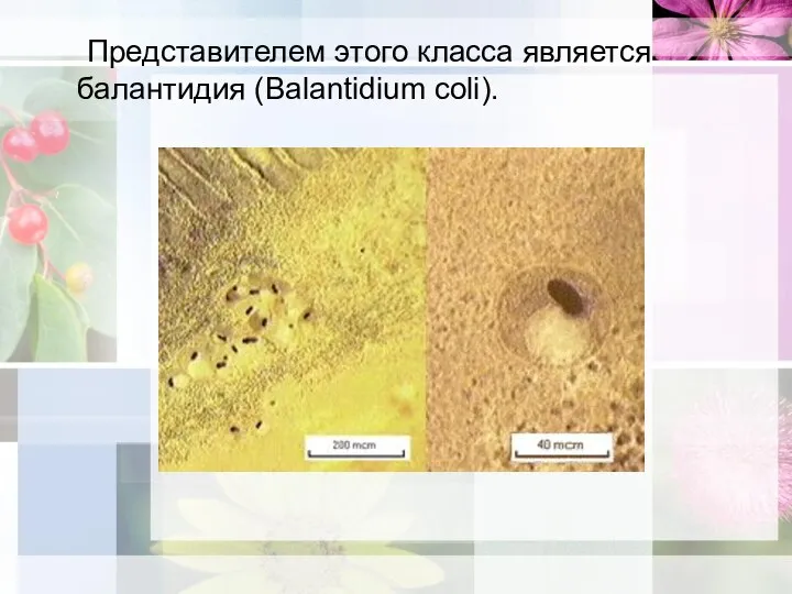 Представителем этого класса является балантидия (Balantidium coli).