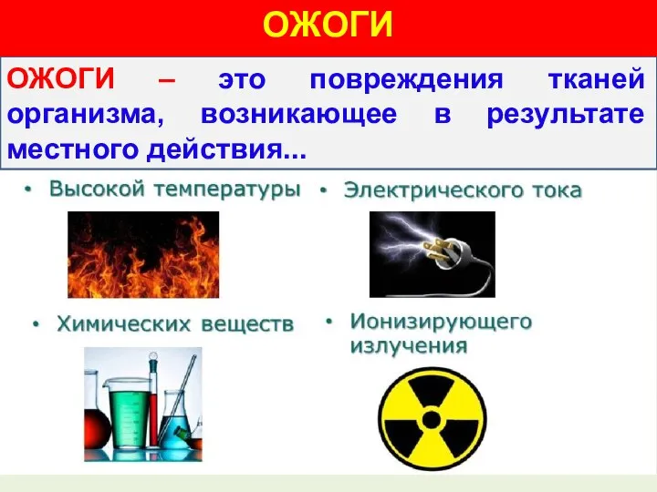 ОЖОГИ – это повреждения тканей организма, возникающее в результате местного действия... ОЖОГИ