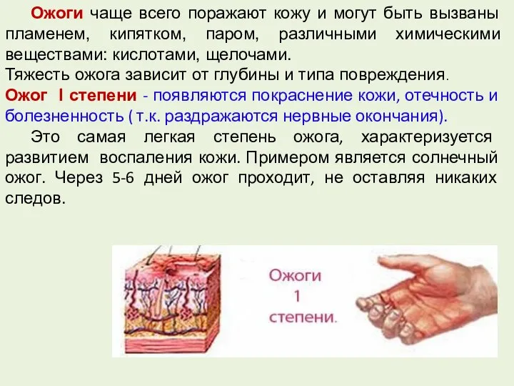 Ожоги чаще всего поражают кожу и могут быть вызваны пламенем, кипятком, паром,