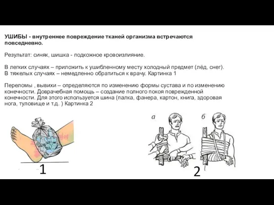 УШИБЫ - внутреннее повреждение тканей организма встречаются повседневно. Результат: синяк, шишка -