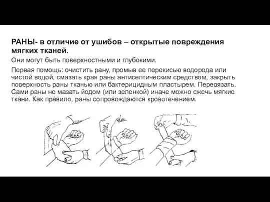 РАНЫ- в отличие от ушибов – открытые повреждения мягких тканей. Они могут