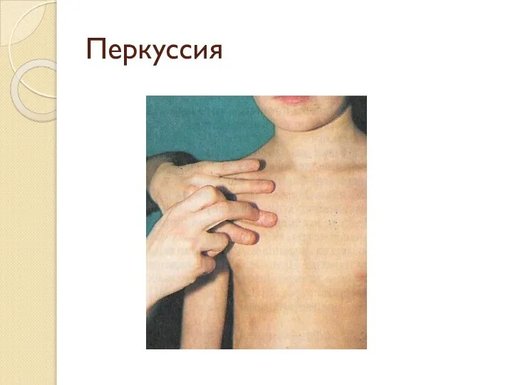 Перкуссия