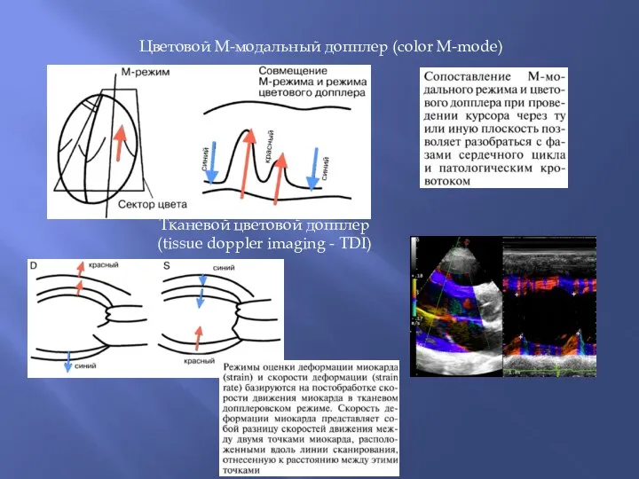 Цветовой М-модальный допплер (color M-mode) Тканевой цветовой допплер (tissue doppler imaging - TDI)