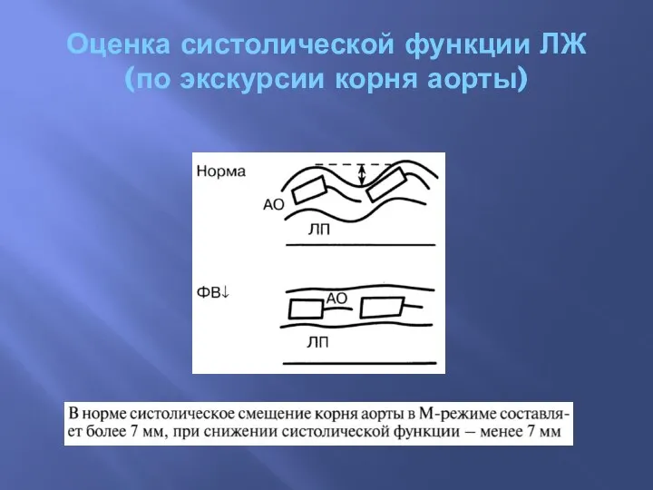 Оценка систолической функции ЛЖ (по экскурсии корня аорты)