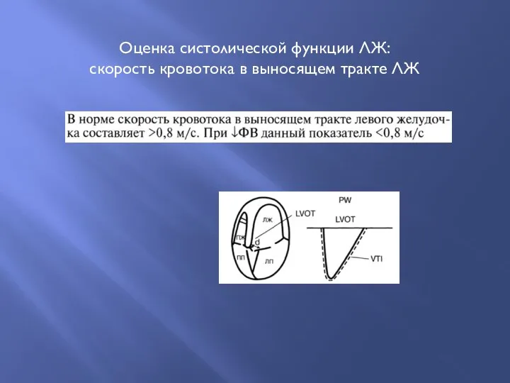 Оценка систолической функции ЛЖ: скорость кровотока в выносящем тракте ЛЖ