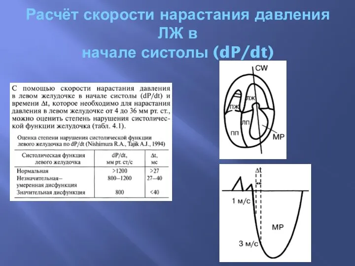 Расчёт скорости нарастания давления ЛЖ в начале систолы (dP/dt)