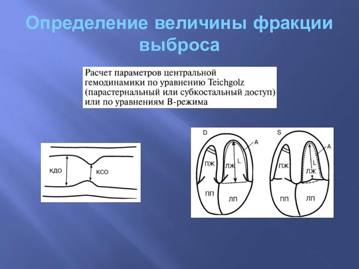 Определение величины фракции выброса