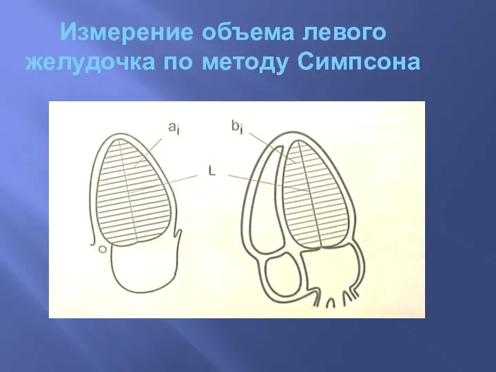 Измерение объема левого желудочка по методу Симпсона