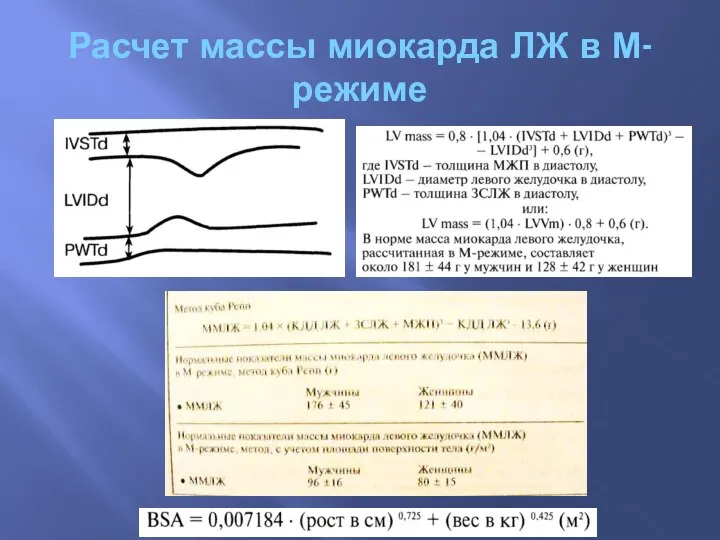 Расчет массы миокарда ЛЖ в М-режиме