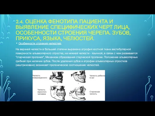 2.4. ОЦЕНКА ФЕНОТИПА ПАЦИЕНТА И ВЫЯВЛЕНИЕ СПЕЦИФИЧЕСКИХ ЧЕРТ ЛИЦА, ОСОБЕННОСТИ СТРОЕНИЯ ЧЕРЕПА.