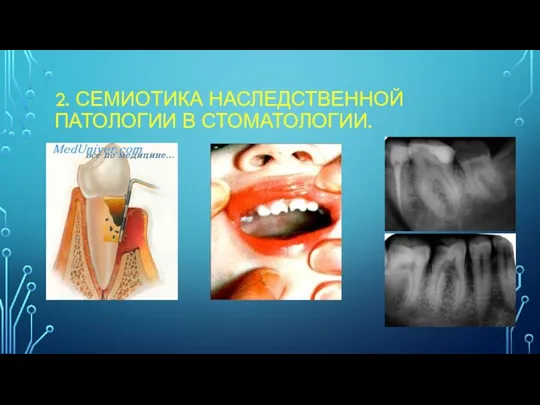 2. СЕМИОТИКА НАСЛЕДСТВЕННОЙ ПАТОЛОГИИ В СТОМАТОЛОГИИ.