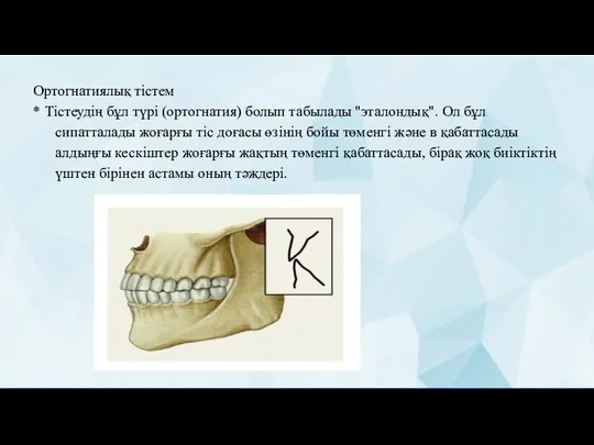 Ортогнатиялық тістем * Тістеудің бұл түрі (ортогнатия) болып табылады "эталондық". Ол бұл