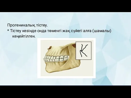 Прогеникалық тістеу. * Тістеу кезінде онда төменгі жақ сүйегі алға (шамалы) кеңейтілген.