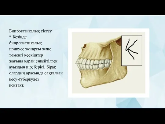 Бипрогатикалық тістеу * Кезінде бипрогнатикалық прикусе жоғарғы және төменгі кескіштер жағына қарай