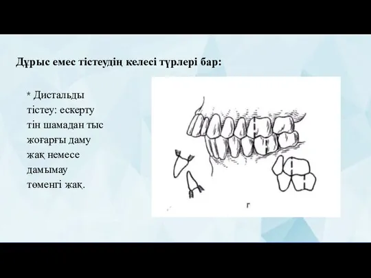 Дұрыс емес тістеудің келесі түрлері бар: * Дистальды тістеу: ескерту тін шамадан