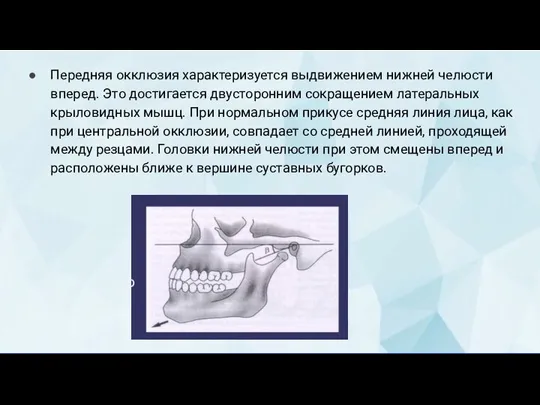 Передняя окклюзия характеризуется выдвижением нижней челюсти вперед. Это достигается двусторонним сокращением латеральных