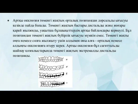 Артқы окклюзия төменгі жақтың орталық позициядан дорсальды ығысуы кезінде пайда болады. Төменгі