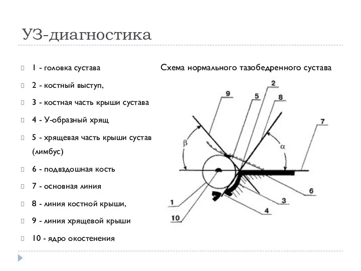 УЗ-диагностика 1 - головка сустава 2 - костный выступ, 3 - костная