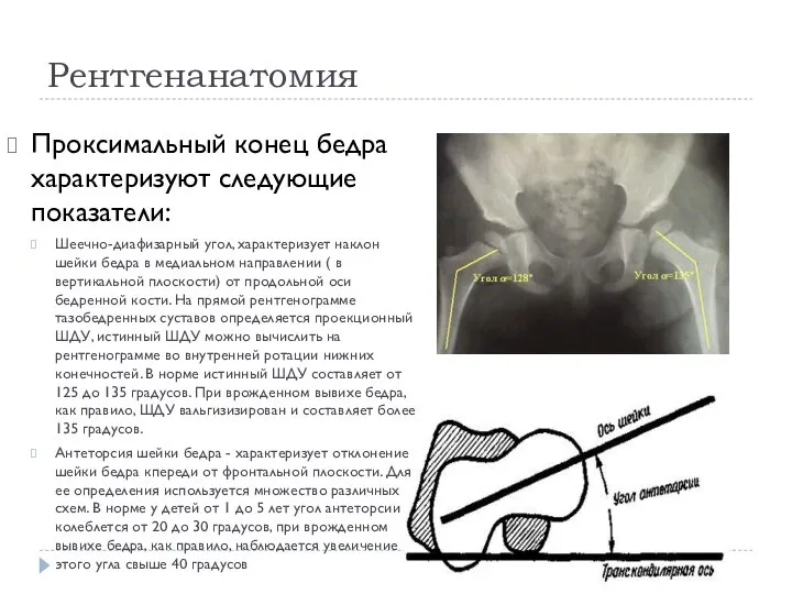 Рентгенанатомия Проксимальный конец бедра характеризуют следующие показатели: Шеечно-диафизарный угол, характеризует наклон шейки