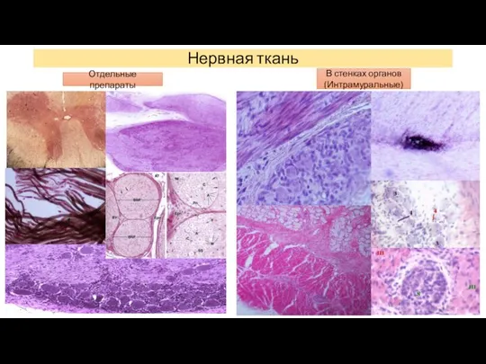 Нервная ткань Отдельные препараты В стенках органов (Интрамуральные)