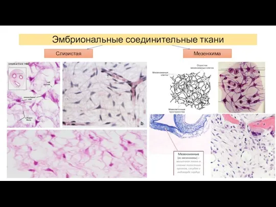 Эмбриональные соединительные ткани Слизистая Мезенхима
