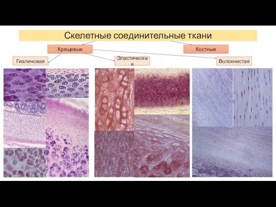 Скелетные соединительные ткани Хрящевые Костные Гиалиновая Эластическая Волокнистая