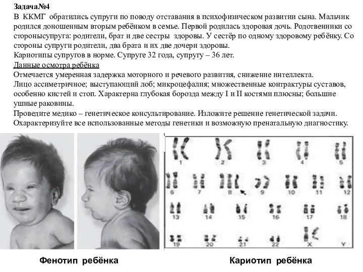 Фенотип ребёнка Кариотип ребёнка Задача№4 В ККМГ обратились супруги по поводу отставания