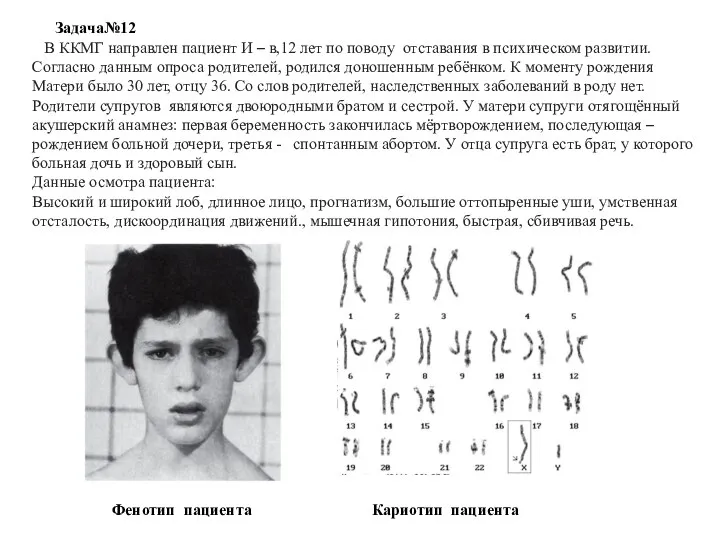 В ККМГ направлен пациент И – в,12 лет по поводу отставания в