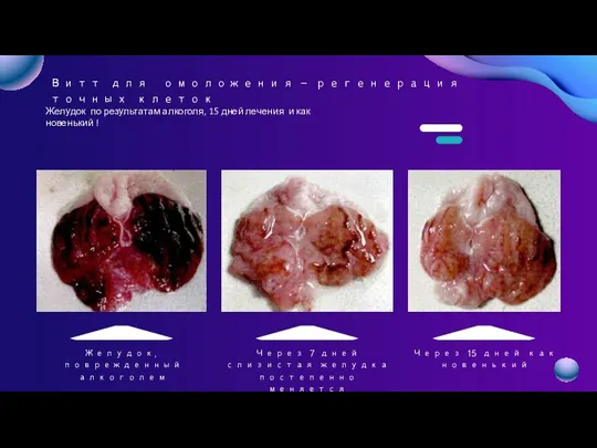 Желудок, поврежденный алкоголем Через 7 дней слизистая желудка постепенно меняется Через 15