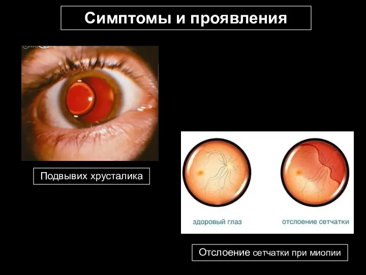 Симптомы и проявления